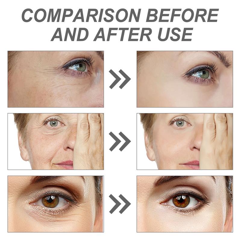 Retinol Rimpelverwijderend Gez - Milk Thistle Silymarin recensie en prijs